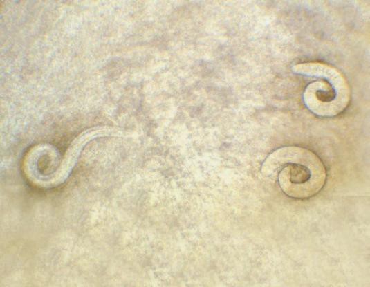 Рис. 7. Личинки протостронгилид в ноге моллюска Helicella derbentina